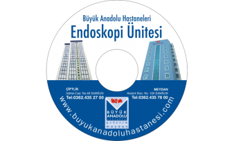 Büyük Anadolu Hastanesi CD Baskı İşlemi