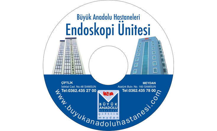 Büyük Anadolu Hastanesi CD Baskı İşlemi
