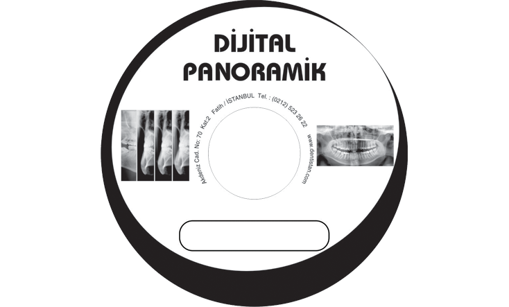 Dijital Panoramik Hastanesi CD Baskı